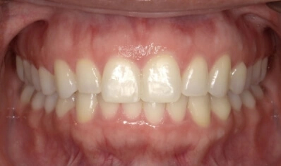 Virtual Dental Consultation Las Vegas