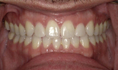 Emergency Dentist Las Vegas