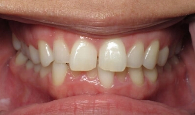 Virtual Dental Consultation Las Vegas