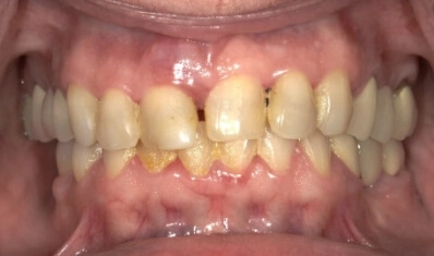 Las Vegas Cosmetic Dentist