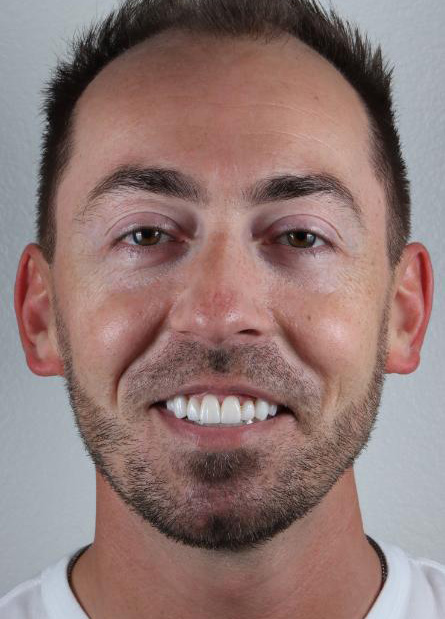 Stunning Smiles | Periodontal Treatment, All-on-6® Dental Implants and Preventive Dentistry