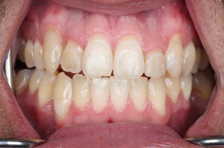 Stunning Smiles | Restorative Dentistry, Same-Day Dental Crowns and Smile Makeovers