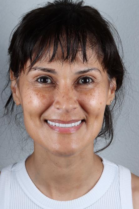 Stunning Smiles | Periodontal Treatment, Smile Makeovers and Same-Day Dental Crowns