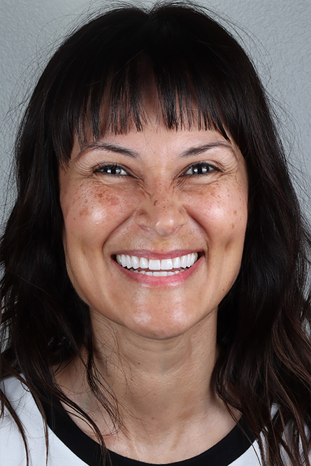 Stunning Smiles | Same-Day Dental Crowns, Dental Fillings and Periodontal Treatment