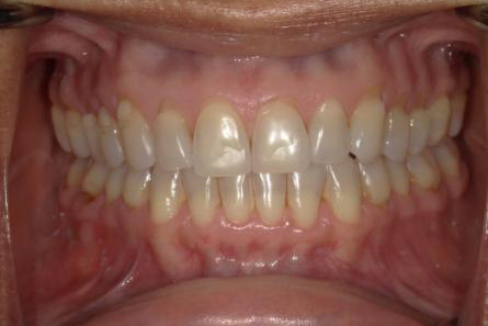 Stunning Smiles | Smile Makeovers, Restorative Dentistry and Cosmetic Dentistry