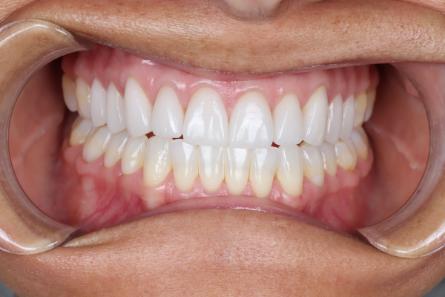 Stunning Smiles | Cosmetic Dentistry, Smile Makeovers and Restorative Dentistry