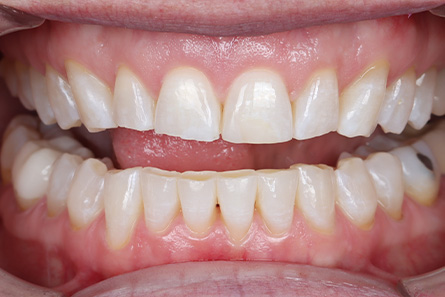 Stunning Smiles | Teeth Whitening, Preventive Dentistry and Periodontal Treatment