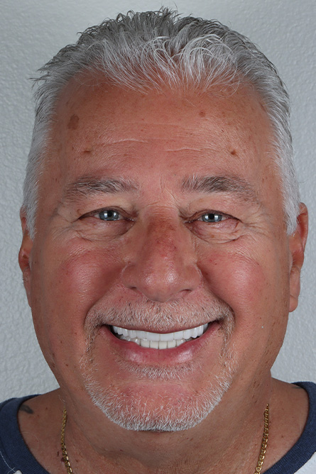 Stunning Smiles | Dental Implants, Preventive Dentistry and Restorative Dentistry