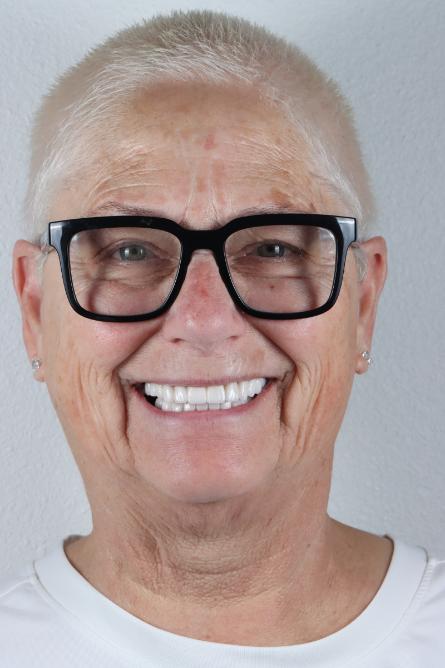 Stunning Smiles | Same-Day Dental Crowns, Restorative Dentistry and Periodontal Treatment