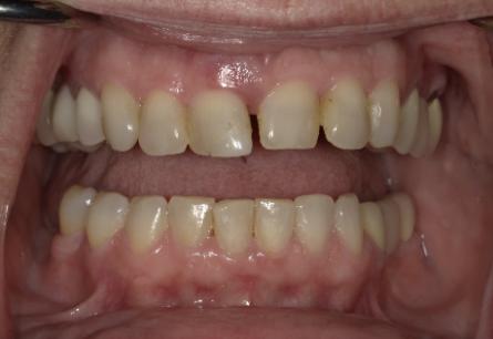 Stunning Smiles | Dental Implants, Periodontal Treatment and Preventive Dentistry