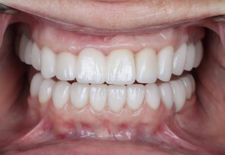 Stunning Smiles | Teeth Whitening, Cosmetic Dentistry and Invisalign®