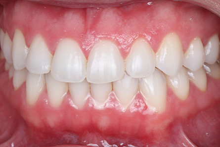 Stunning Smiles | Dental Implants, Invisalign reg  and Restorative Dentistry