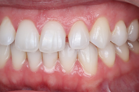 Stunning Smiles | Same-Day Dental Crowns, Cosmetic Dentistry and Dental Implants