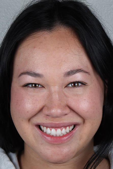 Stunning Smiles | Dental Exams, Cosmetic Dentistry and Same-Day Dental Crowns