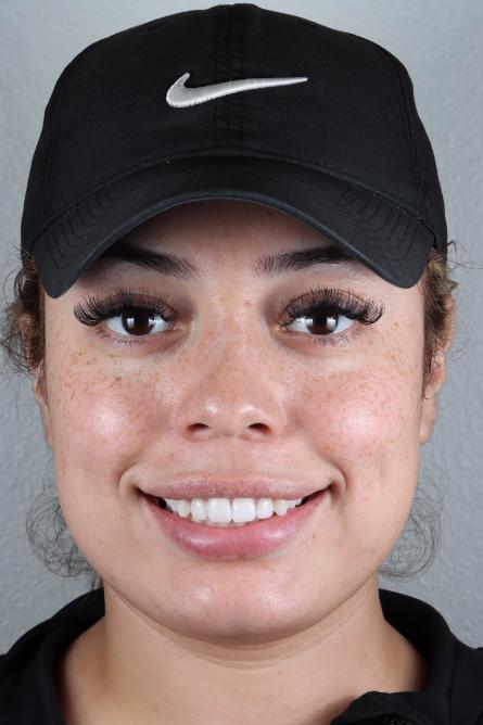 Stunning Smiles | Cosmetic Dentistry, Periodontal Treatment and Invisalign®