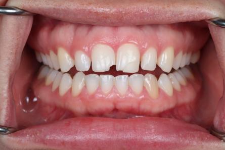 Stunning Smiles | Invisalign®, Emergency Dentistry and Preventive Dentistry