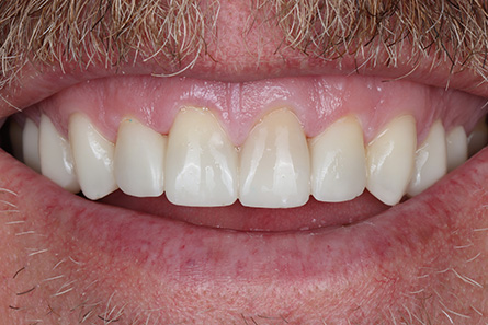 Stunning Smiles | Dental Implants, Invisalign reg  and Periodontal Treatment