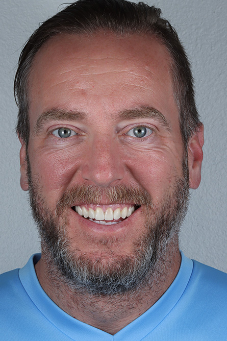 Stunning Smiles | Restorative Dentistry, All-on-6 reg  Dental Implants and Dental Fillings