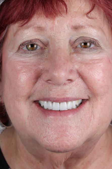 Stunning Smiles | Dental Implants, Preventive Dentistry and Teeth Whitening