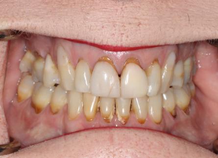 Stunning Smiles | Teeth Whitening, Cosmetic Dentistry and Periodontal Treatment