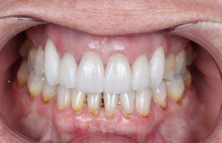 Stunning Smiles | Preventive Dentistry, Teeth Whitening and Invisalign®