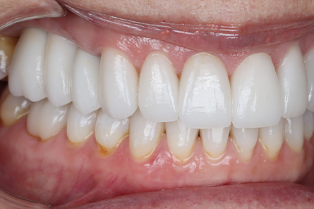 Stunning Smiles | Periodontal Treatment, Dental Exams and Cosmetic Dentistry