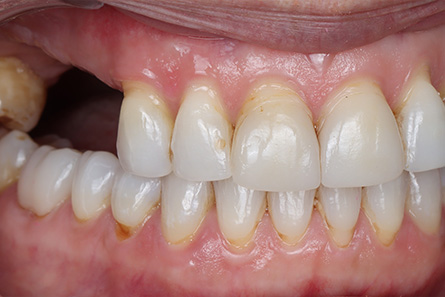 Stunning Smiles | Smile Makeovers, Dental Fillings and Cosmetic Dentistry