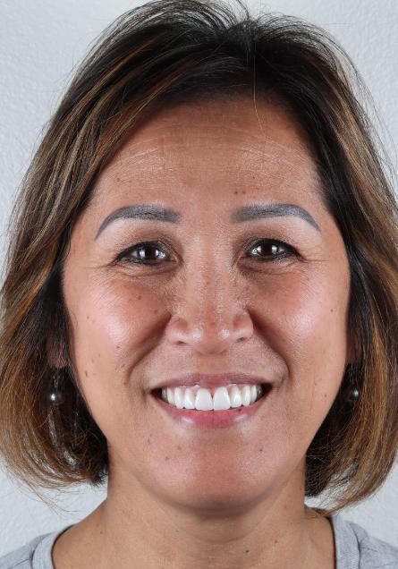 Stunning Smiles | Emergency Dentistry, Cosmetic Dentistry and Restorative Dentistry