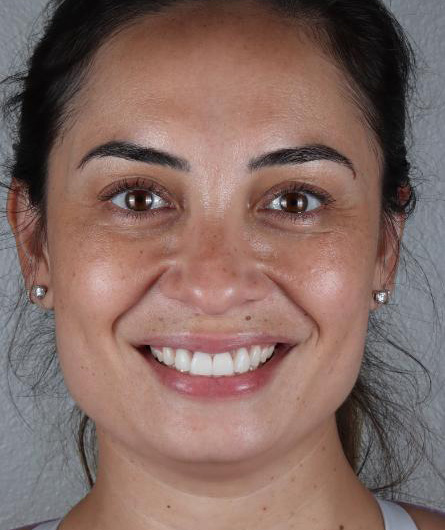 Stunning Smiles | Teeth Whitening, Dental Implants and Preventive Dentistry