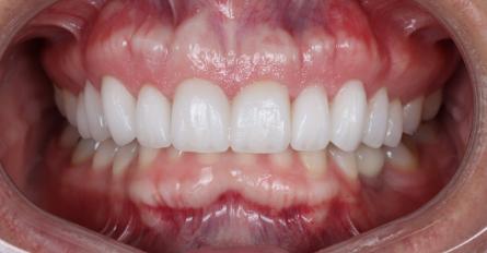 Stunning Smiles | Smile Makeovers, Cosmetic Dentistry and Preventive Dentistry