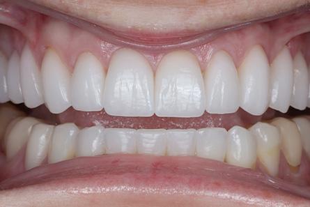 Stunning Smiles | Smile Makeovers, Preventive Dentistry and Emergency Dentistry