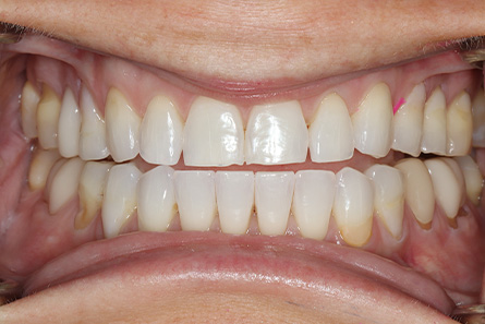 Stunning Smiles | Teeth Whitening, Dental Fillings and Preventive Dentistry