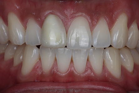 Stunning Smiles | Restorative Dentistry, Teeth Whitening and Dental Fillings