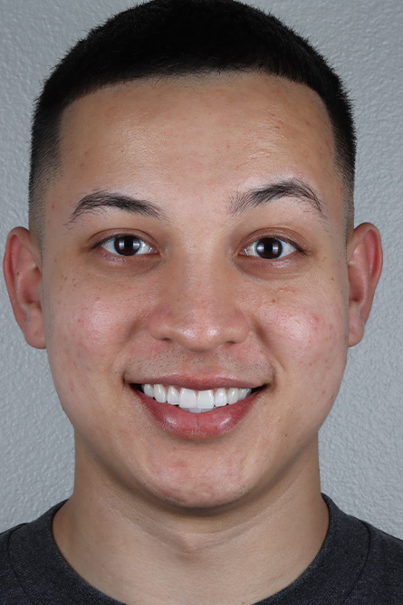 Stunning Smiles | Dental Fillings, Periodontal Treatment and Dental Exams