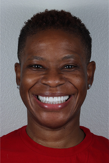 Stunning Smiles | Same-Day Dental Crowns, Teeth Whitening and Dental Exams