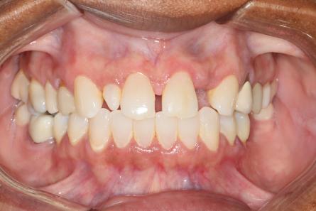 Stunning Smiles | Preventive Dentistry, Same-Day Dental Crowns and Invisalign®